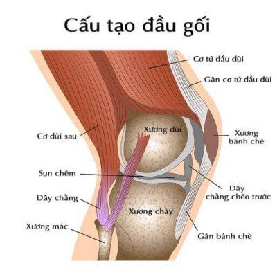 chấn thương đứt dây chằng đầu gối